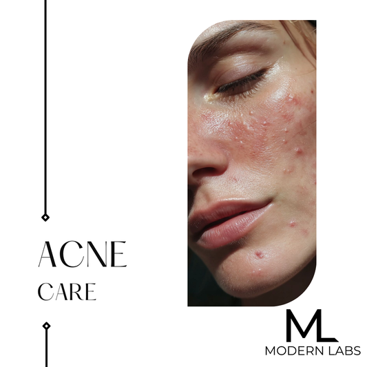 BUNDLE: ACNE SKIN